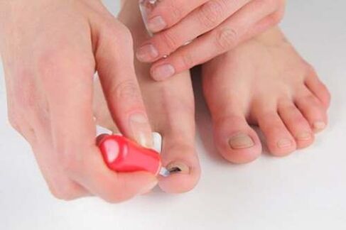 Nail sprouts