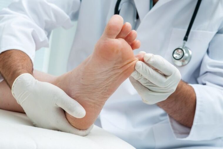 Examination of the feet by a dermatologist