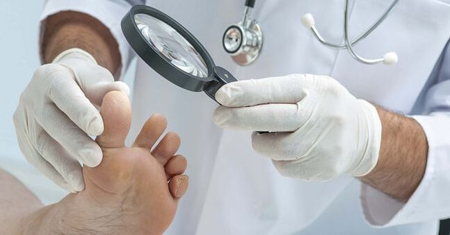 The doctor will prescribe a medicine for toenail fungus after diagnosing the disease